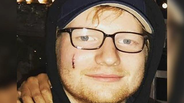 Princess Beatrice slashes Ed Sheeran s face with sword